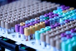 Firm To Present Trial Results Update at SITC Meeting