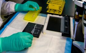 FDA Grants Orphan Drug Status to Experimental Melanoma Therapy After Phase 1 Results